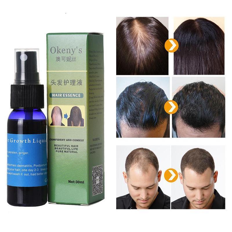 Sunburst Hair Growth Products for women&men anti hair loss products Alopecia Baldness beard oil growth Hair growth spray